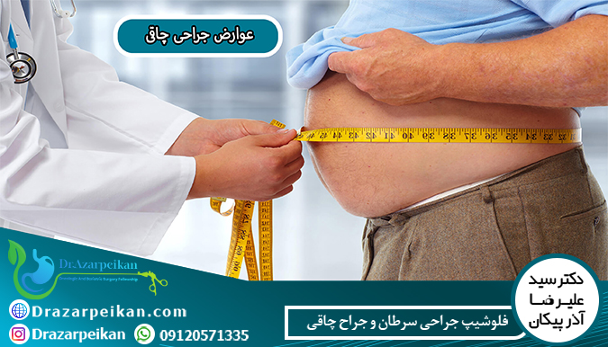 عوارض جراحی چاقی